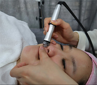 9. Proceed sensitive skin regions