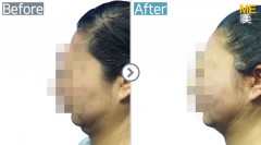 Singapore / Accusculpt