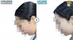 USA / Accusculpt