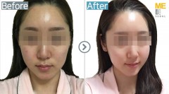 Korea / Rejuran healer