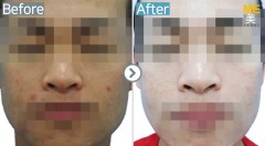 Singapore / Rejuran healer