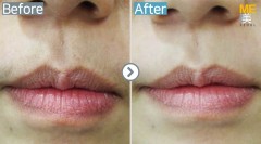 Singapore / Upper lips