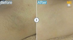 Singapore / Armpit
