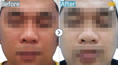 Singapore / Alex toning