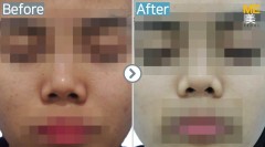 Singapore / Alex toning