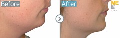 trusculpt