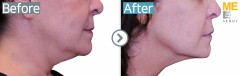 trusculpt