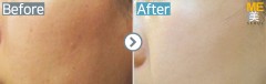 Singapore / Rejuran healer