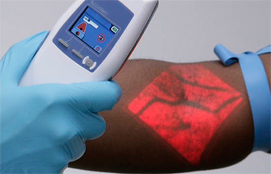 AccuVein