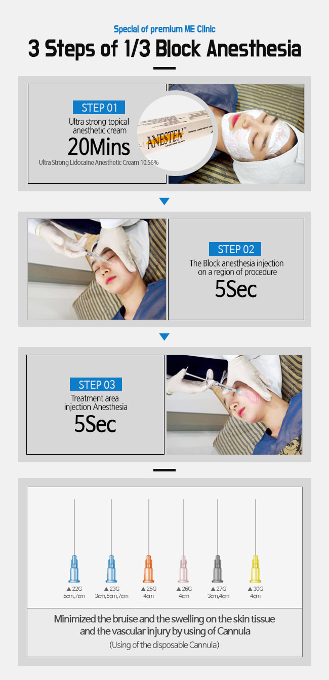 methods for painless procedure - 3 Steps of 1/3 Block Anesthesia